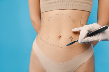 Doctor drawing dashed line marks on female body before plastic surgery operation. Isolated on blue background. Beauty care, anti aging procedures, plastic surgery concept - obrazy, fototapety, plakaty