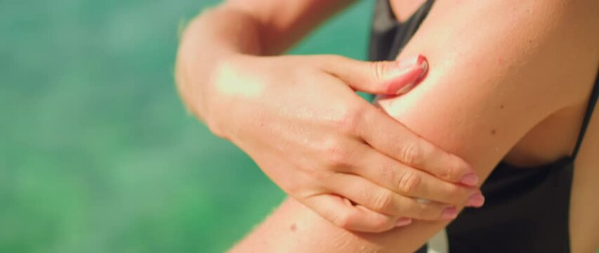 Close-up of a woman's hand applying SPF cream on skin body covered with moles. Girl smears sunscreen on shoulder at beach, sea background.