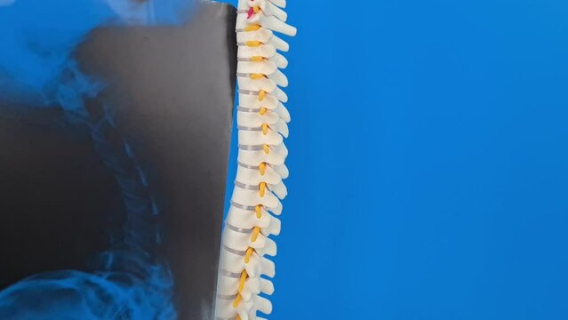 Model of human spine anatomy and diseases and diseases of spinal cord and back pain