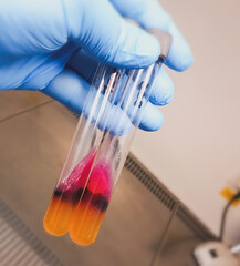Salmonella detection method by using Triple Sugar Iron (TSI) Agar in microbiology laboratory.