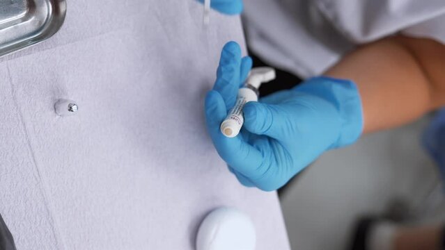 Dentist will use special metal tool to take professional material from tooth filling tube. Fluoride for fluoridation. Modern Dentistry, Vertical Video.