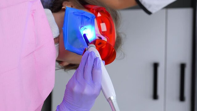 Restoration chewing surface with photopolymer filling material. Dentist working with dental polymerization UV lamp in oral cavity. Modern dentistry. Vertical video