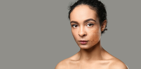 Portrait of beautiful African-American woman with dry and healthy skin on grey background with...