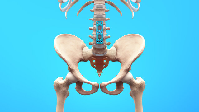 Orthopedic Spine Fixation Spinal Fixator Anterior Lumbar Plate	