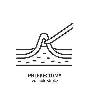 Phlebectomy varicose veins line icon. Surgery to remove a vein cluster vector symbol. Editable stroke.