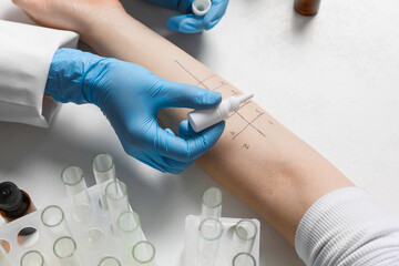 Doctor doing skin allergy test at light table, closeup