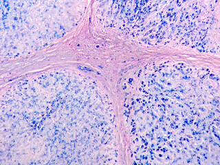 Liver with hemosiderin pigment, Perls Stain 10x