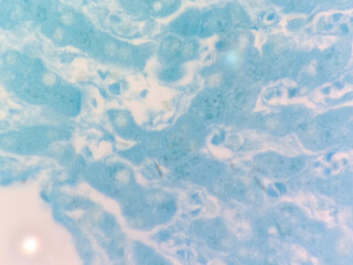 Liver with Lipofuscin Pigment with Schmorl stain 40x