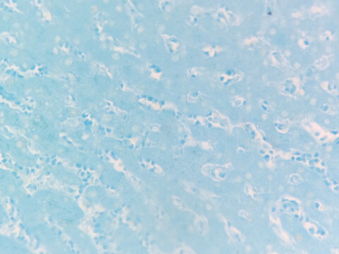 Liver with Lipofuscin Pigment with Schmorl stain 10x