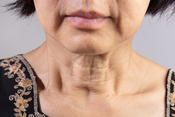 Neck  wrinkles and lines of senior woman. Facial and Neck Skin Aging Change on senior woman. - obrazy, fototapety, plakaty