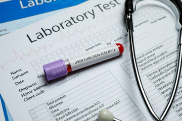 Liver Function Test. Tube with blood sample and stethoscope on laboratory forms