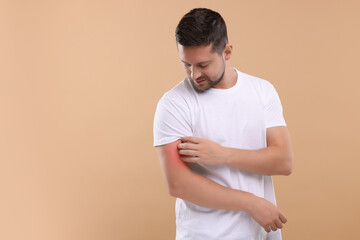 Allergy symptom. Man scratching his arm on light brown background. Space for text