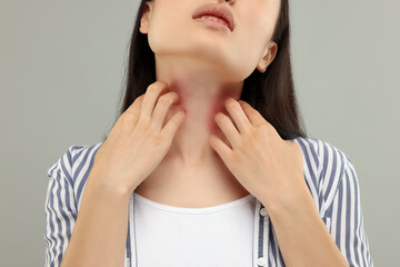 Suffering from allergy. Young woman scratching her neck on grey background, closeup