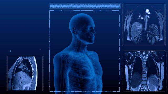 A medically anatomically correct Magnetic resonance scan of the heart. 3D rendering of a chest X-ray scan.
