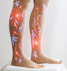 Female legs in compression stockings for varicose veins on the legs. White background. Circulation...