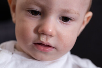 Face of a smiling baby boy with snot from his nose. Runny nose and nasal congestion in children. Virus and bacterial infection, close-up - obrazy, fototapety, plakaty