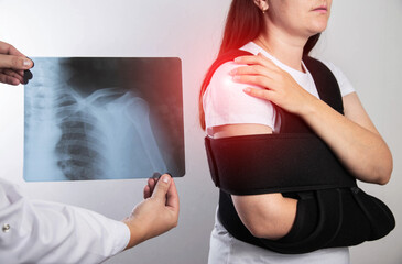 The doctor holds in his hand a medical x-ray of a dislocated humerus and a fractured collarbone against the background of a girl patient whose shoulder hurts. Fixing bandage for the shoulder joint.  - obrazy, fototapety, plakaty