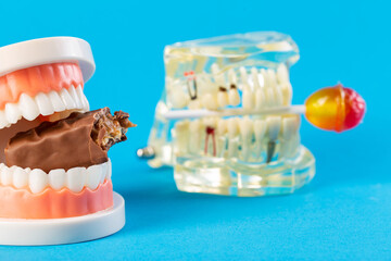 Two mock-ups of dental jaws with a lollipop and a chocolate bar on a blue background. The concept...
