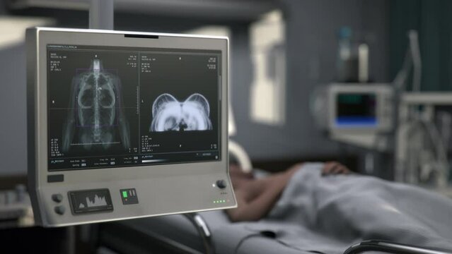 Medical imaging technology examining the chest of the sick patient at a clinic. Medical imaging technology inspecting the breast. Medical imaging technology used for cancer prevention.