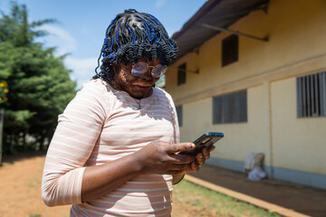Young African burned face girl on her smartphone writing messages