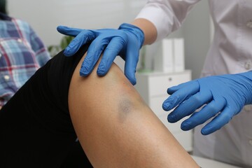 Doctor checking boy's leg with bruise at hospital, closeup