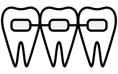 歯科：歯並びの矯正で使う矯正器具、メタルブラケット