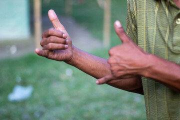 A man is pointing his two thumbs up and one finger down and blurred background