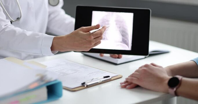 Doctor showing xray image of lungs to patient on digital tablet 4k movie slow motion. Diagnosis and treatment of pneumonia concept