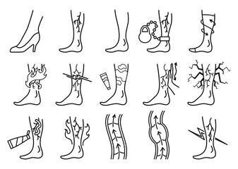 Varicose treatment icons set in coloring style. Violation of circulatory system. Vascular disease diagnostic. Venous insufficiency medical disease. Vector illustration