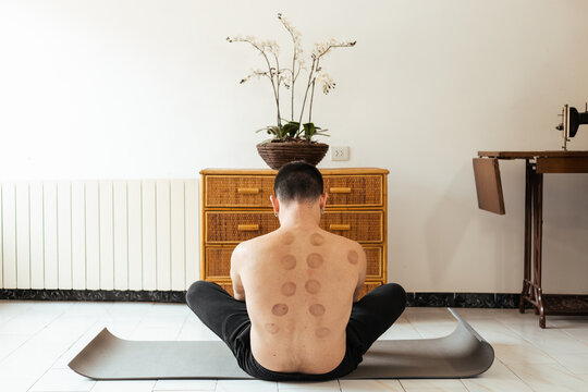 Faceless man in lotus posture during rehabilitation session