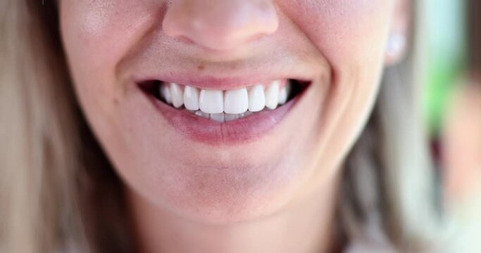 Laughing woman with perfect teeth and porcelain veneers. Teeth whitening and dentistry concept