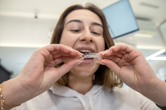  young Caucasian woman holding an invisible aligner that she wants to put on her teeth.