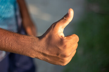 A man's thumb is pointing up and the background is blurred