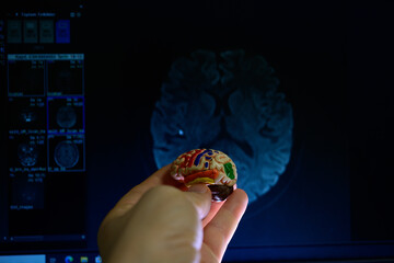 Radiological image of the brain in the back of a hand-held brain model