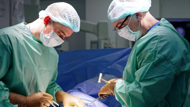 Busy male surgeon bent over the patient on operational table. Main doctor applies mallet and chisel.