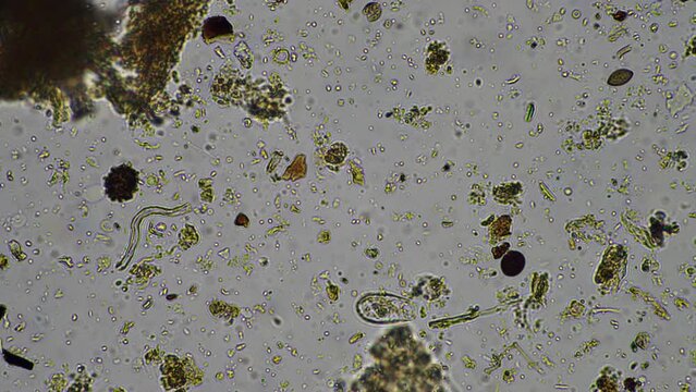 soil microorganisms under the microscope, including, fungi hyphae