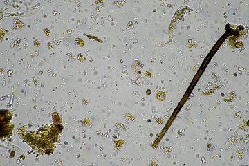 soil microorganism under the microscope recycling nutrients in a compost on a regenerative...