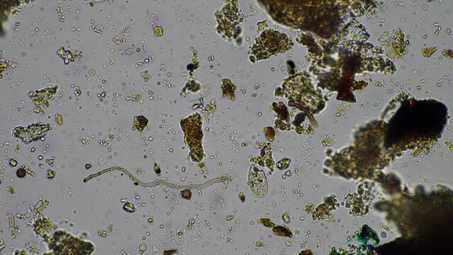 soil microorganisms under the microscope, including, fungi hyphae