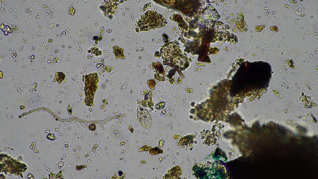 soil microorganisms under the microscope, including, fungi hyphae