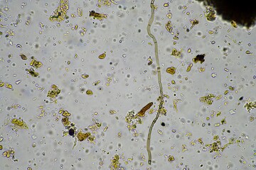 soil microorganism under the microscope recycling nutrients in a compost on a regenerative...