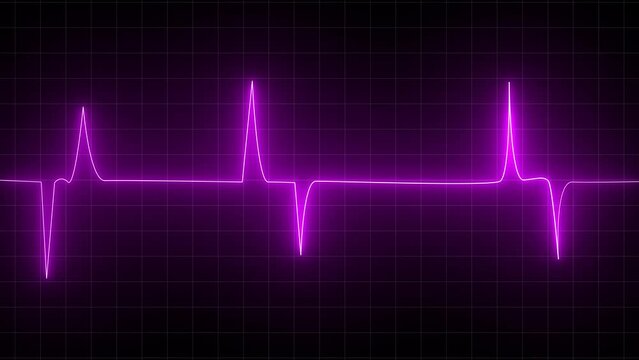 Animated solar neon with heartbeat animation