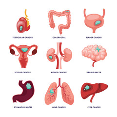 Set of different types of Common cancer types set collection, Testicular, Colorectal, Bladder, Uterus, Kidney, Brain, Stomach, Lung, Liver, malignant inflammation. Human organ tumor poster.