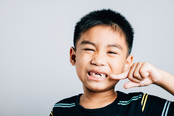 Child an Asian boy highlights dental care by pointing to missing front tooth. White background...