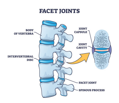 Facet joints anatomy with bone capsule and cavity closeup outline diagram. Labeled educational medical explanation with body of vertebra, intervertebral disc and spinous process vector illustration.