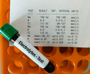 Blood sample for electrolytes test with abnormal report, Hypernatremia