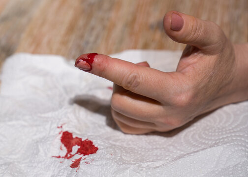 A woman's hand with a cut finger, bleeding heavily.