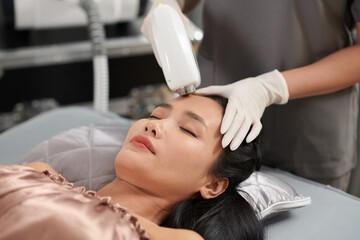 Closeup image of woman getting hair from forehead removed with diode laser machine