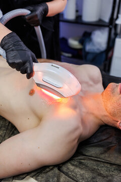 Laser epilation of a man's chest. Male body care. A man with protective glasses and a bare chest undergoes a laser hair removal procedure in a clinic
