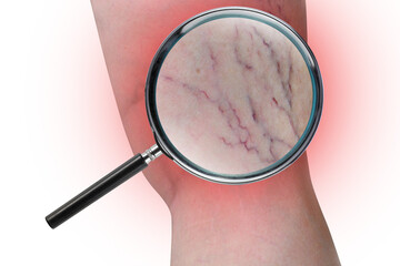 Leg capillary magnifier PNG transparent