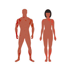 Standing adult man and woman with painful rash
